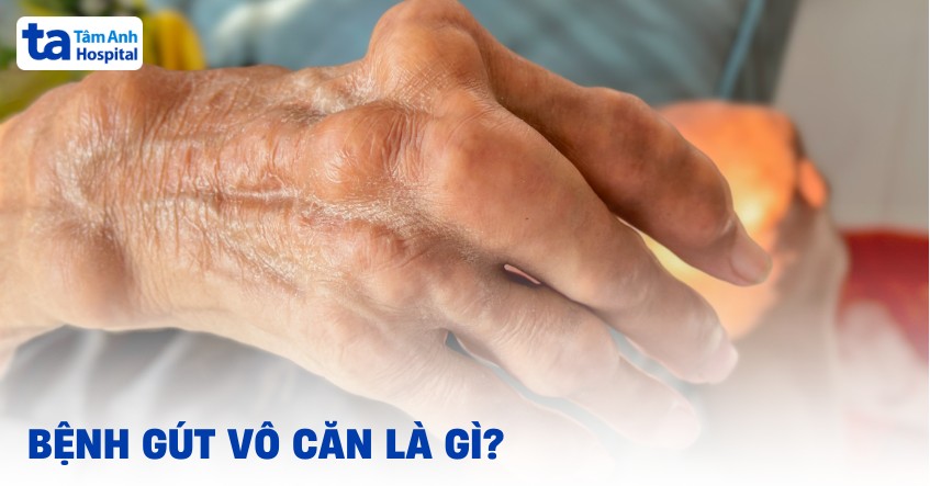 Bệnh gút vô căn là gì? Nguyên nhân, triệu chứng và cách điều trị
