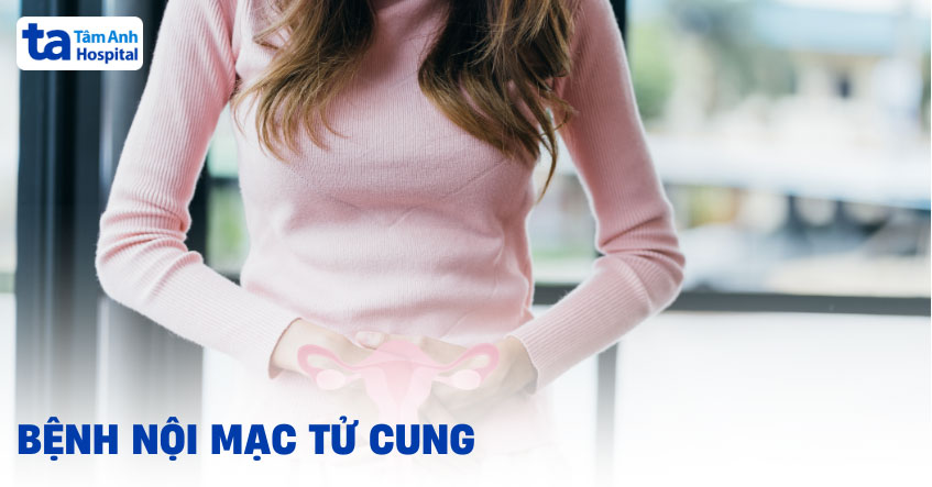 Bệnh nội mạc tử cung thường gặp: Nguyên nhân, dấu hiệu