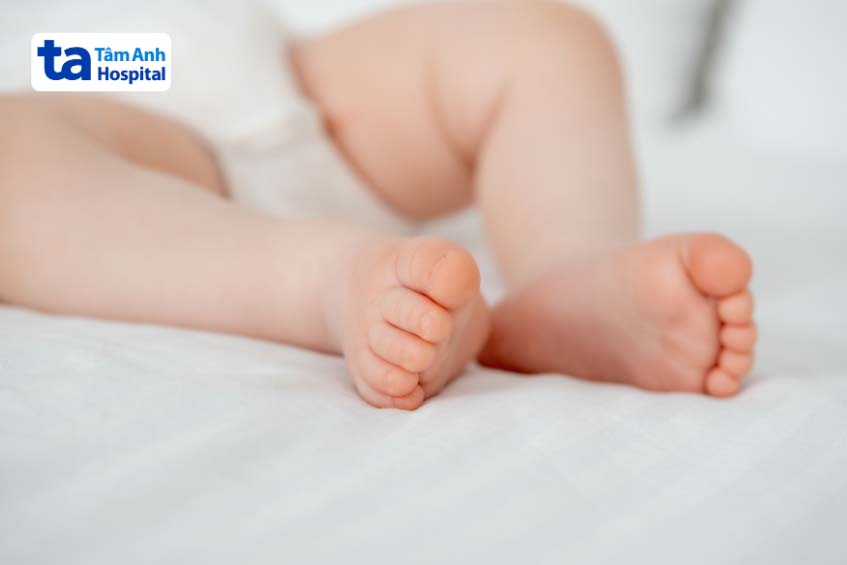 Bệnh SCID thường phát hiện ở độ tuổi nào