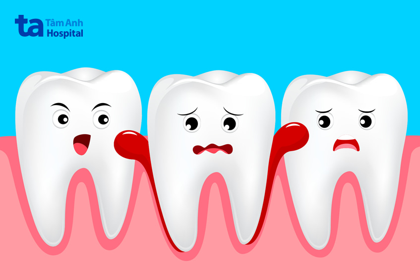 Bệnh lý tủy răng có nguy hiểm không?