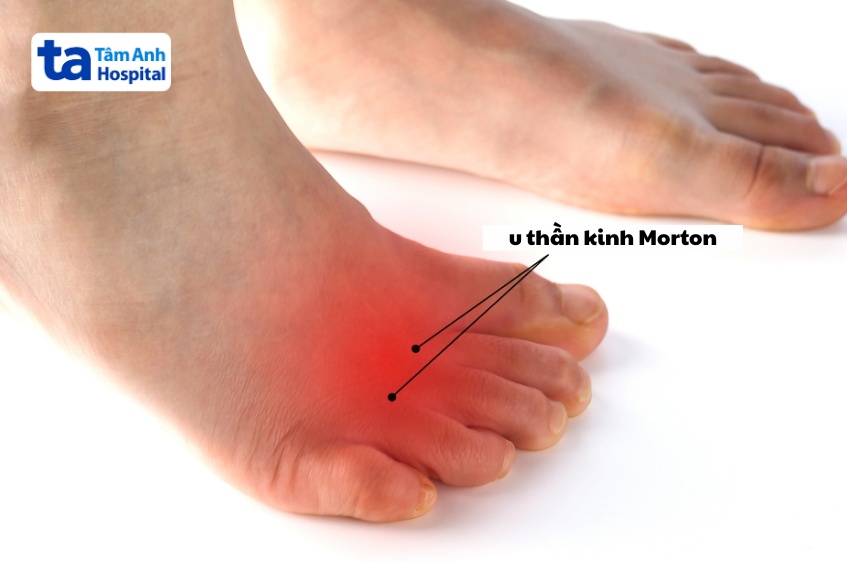 Onlayn buvilar uchun porno videolar Chelyabinskdagi uyda jinsiy aloqa