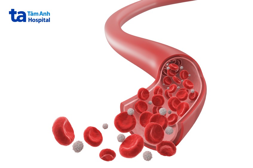 bệnh về máu gây biến chứng