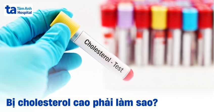 Bị cholesterol cao phải làm sao? 8 cách điều trị hiệu quả