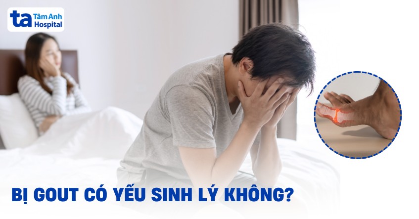 Bị gout có yếu sinh lý không? Cách chẩn đoán và điều trị hiệu quả