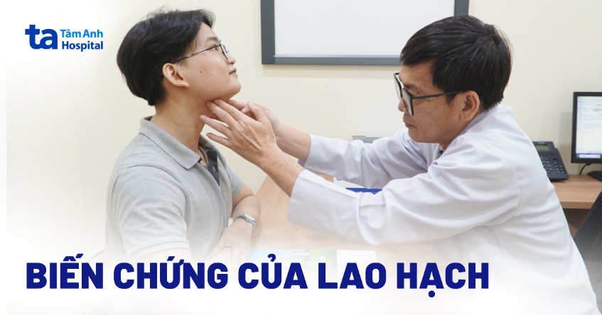 6 biến chứng của lao hạch thường gặp và cách khắc phục