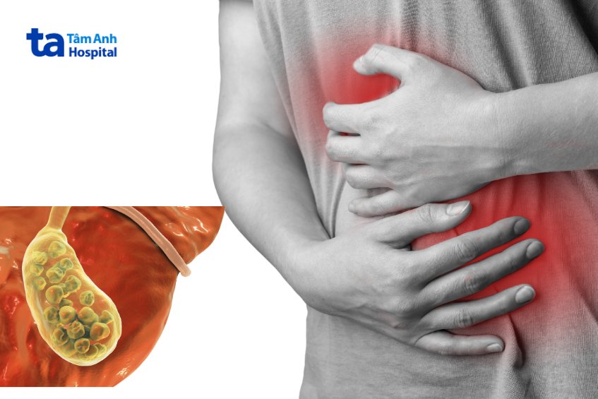 biến chứng viêm túi mật