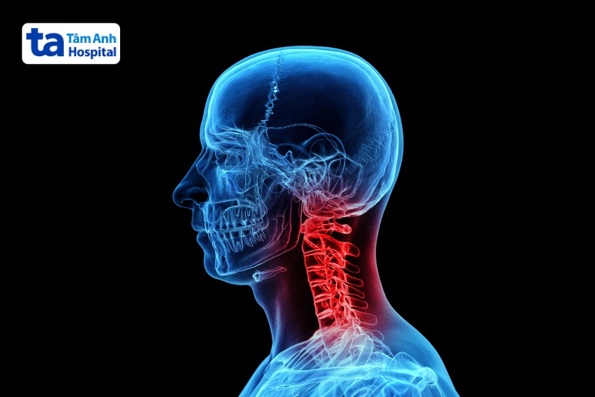 biểu hiện tình trạng khối u cột sống