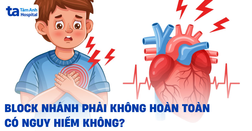 Block nhánh phải không hoàn toàn có nguy hiểm không? [Giải Đáp]