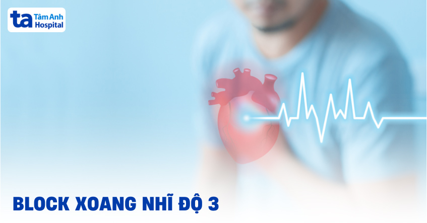Block xoang nhĩ độ 3 có nguy hiểm không? Cách chẩn đoán, điều trị