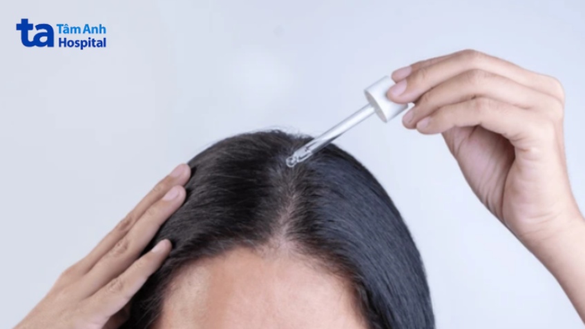 bôi thuốc chứa hoạt chất diệt ký sinh trùng