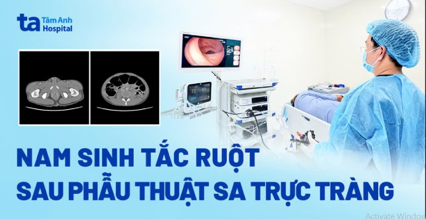 ca bệnh tắc ruột sau phẫu thuật trực tràng