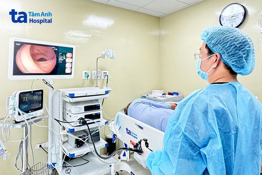 ca nội soi đại tràng