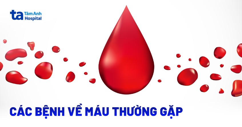 Các bệnh về máu thường gặp: Nguyên nhân, triệu chứng và chẩn đoán