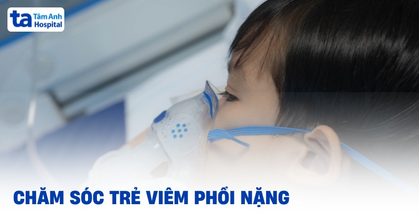 5 cách chăm sóc trẻ viêm phổi nặng giúp bé mau hồi phục sức khỏe