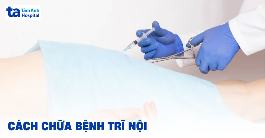 11 cách chữa bệnh trĩ nội hiện nay an toàn và hiệu quả