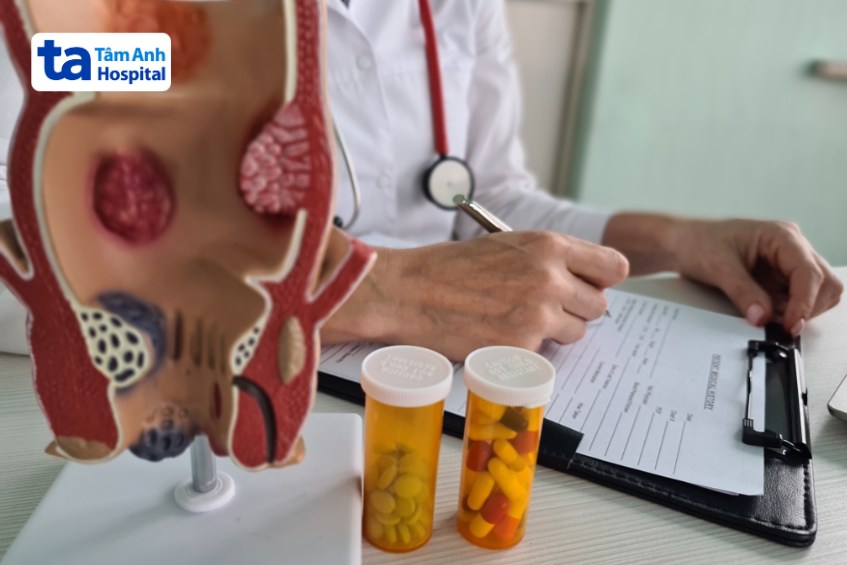 cách chữa sa búi trĩ