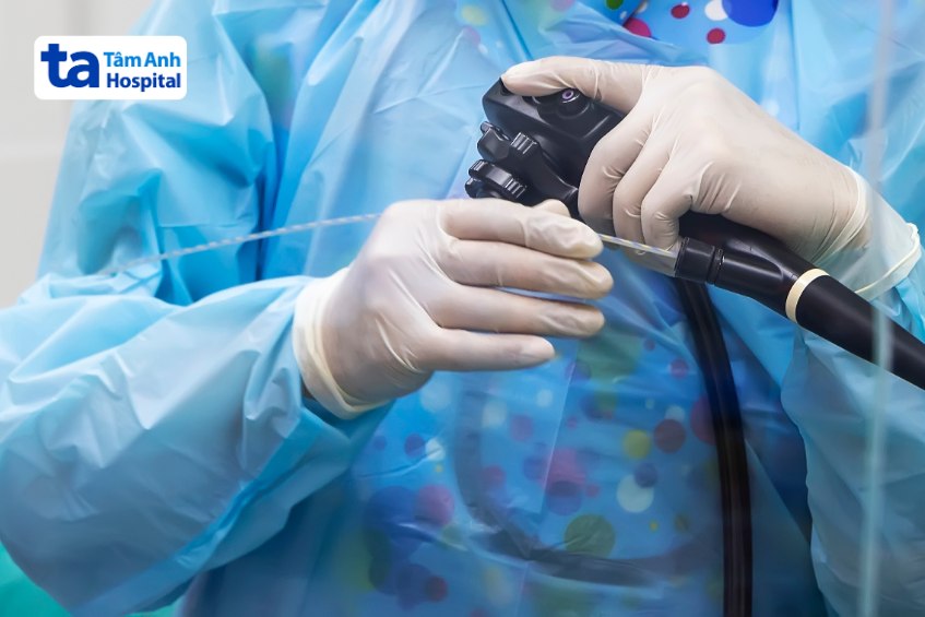 cách điều trị viêm túi mật không do sỏi