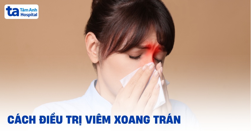 12 cách điều trị viêm xoang trán hiệu quả nên tham khảo