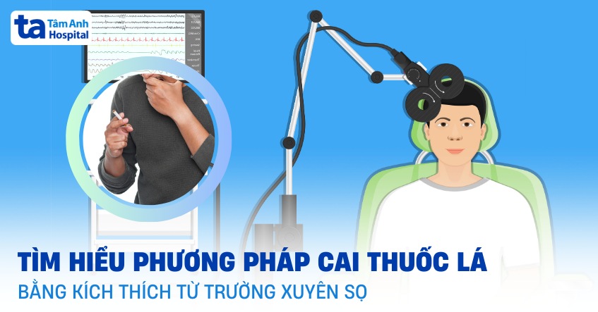 Tìm hiểu cai thuốc lá bằng kích thích từ trường xuyên sọ như thế nào?