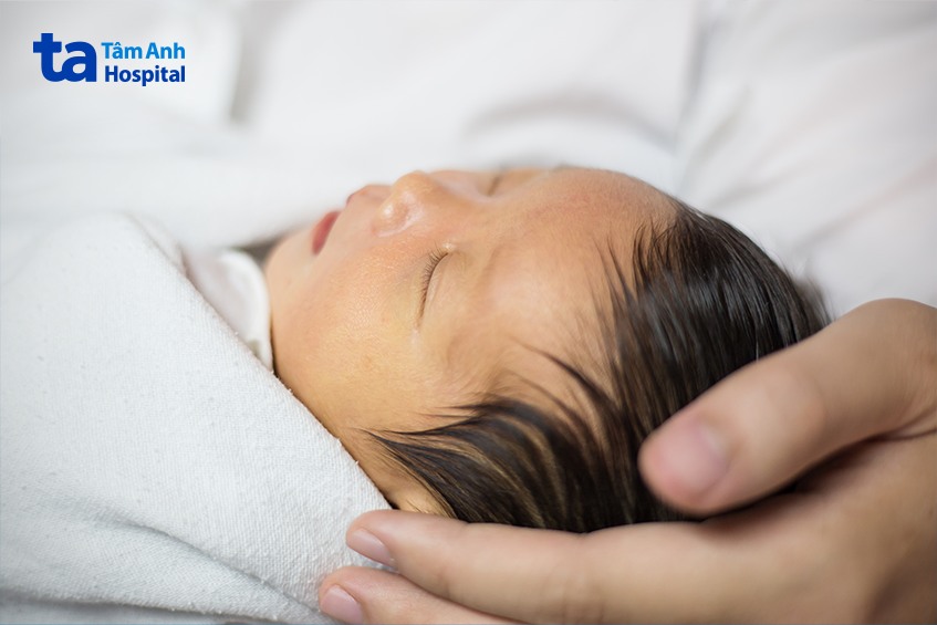 cần theo dõi tình trạng vàng da sơ sinh