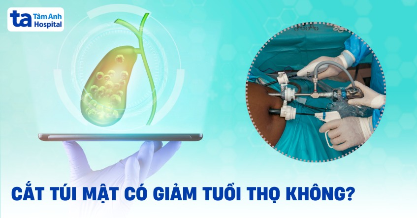 Cắt túi mật có giảm tuổi thọ không? Làm sao để sống khỏe mạnh?