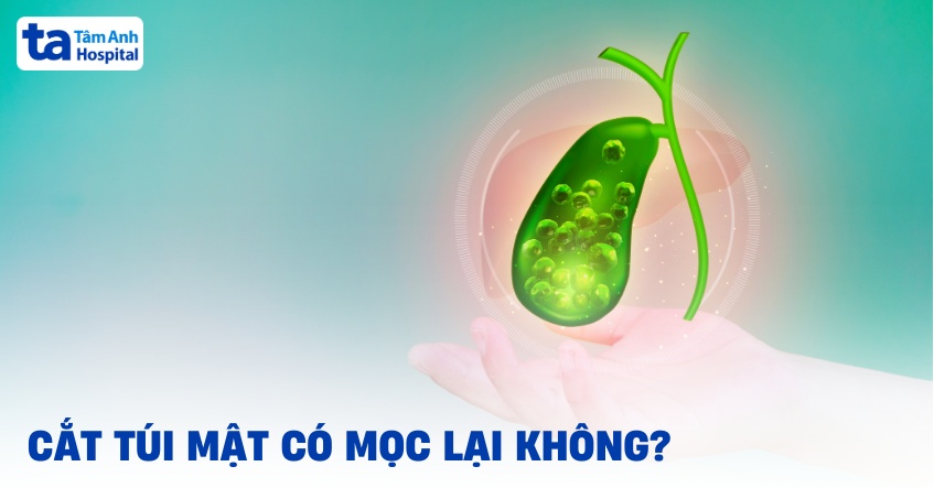 Cắt túi mật có mọc lại không? Có ảnh hưởng sức khỏe?