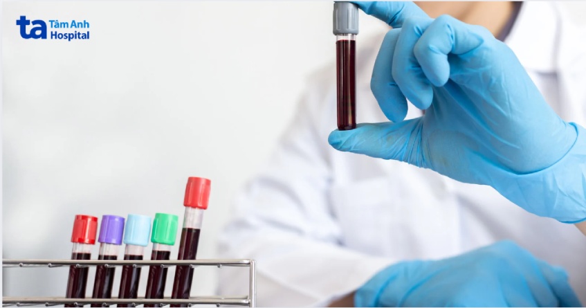 chẩn đoán hội chứng thận hư nguyên phát