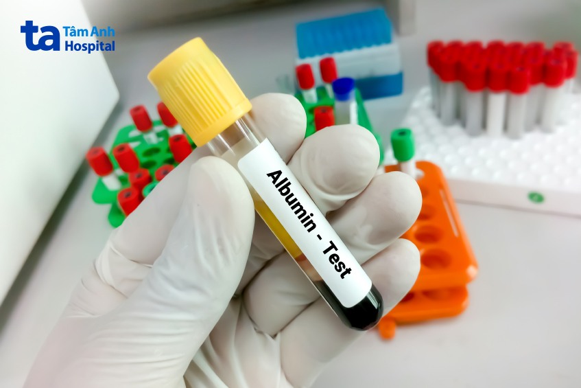 chẩn đoán hội chứng thận hư tái phát