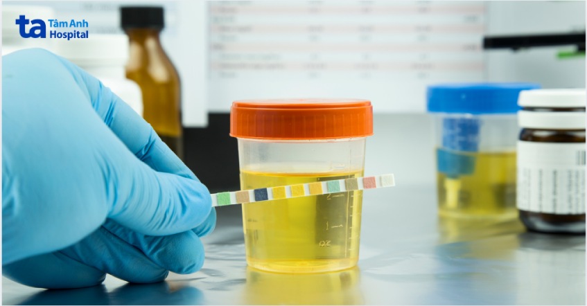 chẩn đoán tiểu không tự chủ ở bệnh nhân ung thư