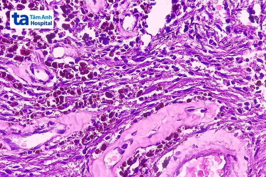 Baradina yalangoch va jinsiy aloqa video Yalangoch Nyusha oyoqlarini yoyadi