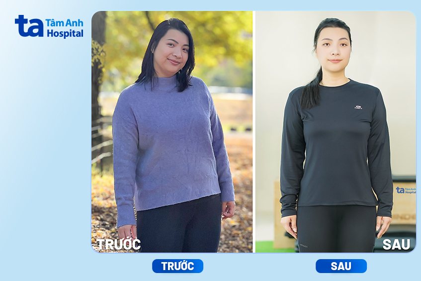 chị hà trước và sau khi giảm cân