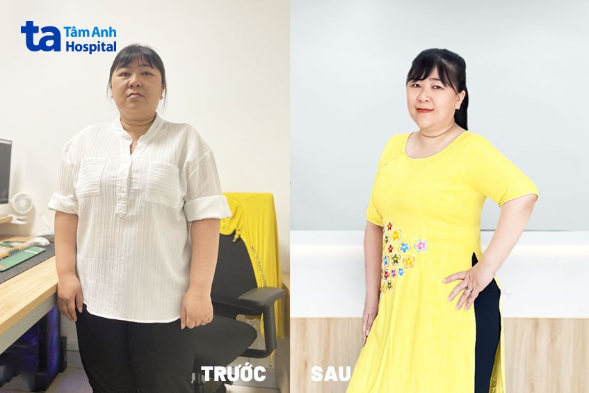 chị loan trước và sau khi giảm cân