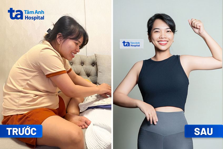 chị thảo giảm được 6kg sau 3 tháng