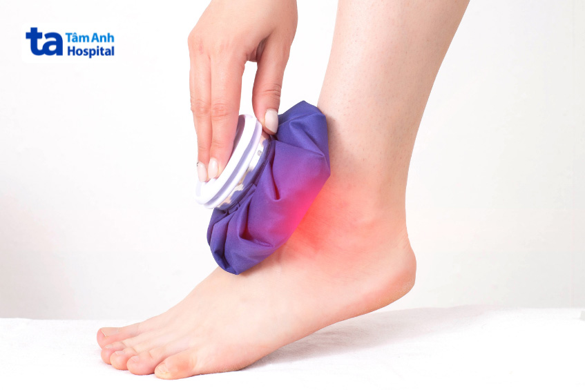 Chườm nóng chườm lạnh cải thiện viêm khớp cổ chân