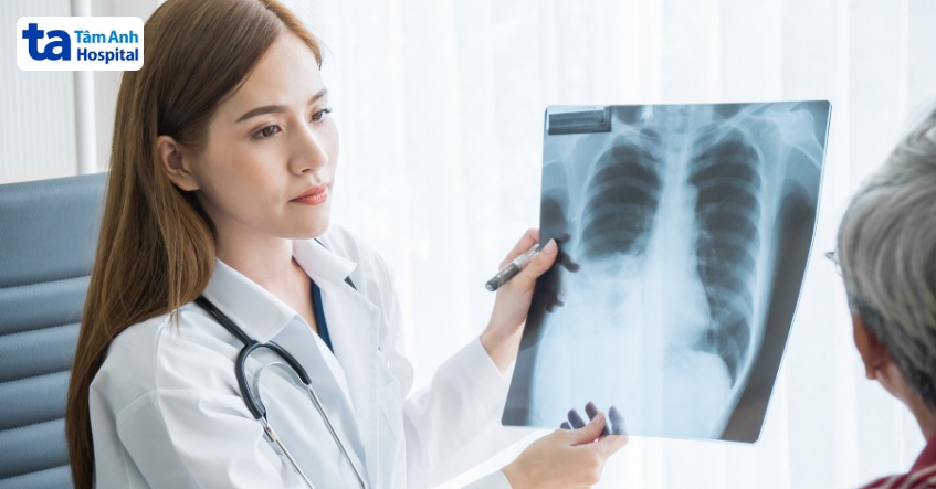 chụp cắt lớp 128 dãy