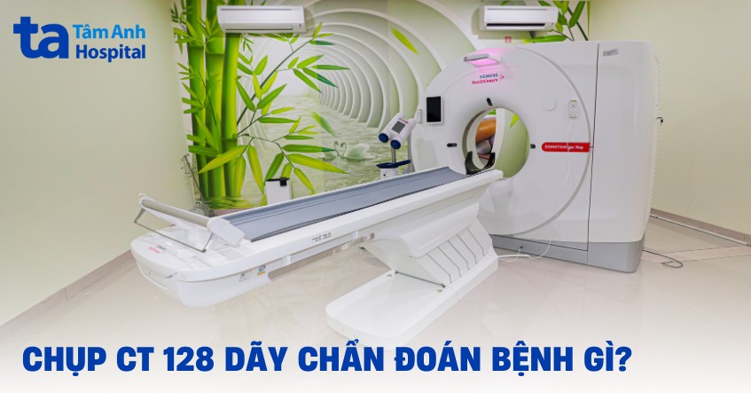 Chụp CT 128 dãy: Ưu điểm, chẩn đoán bệnh gì, quy trình thực hiện?
