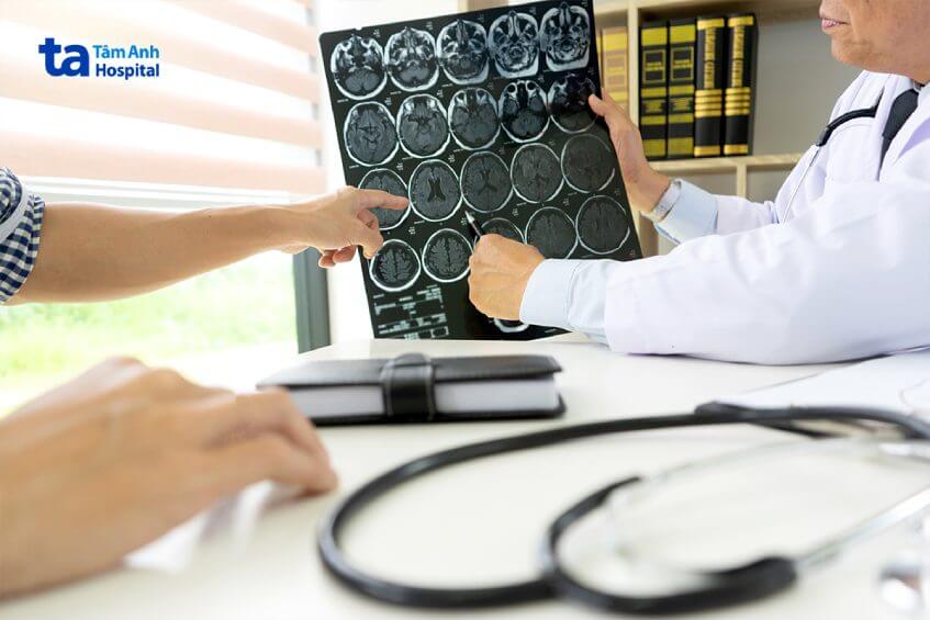 chụp ct 128 lát cắt