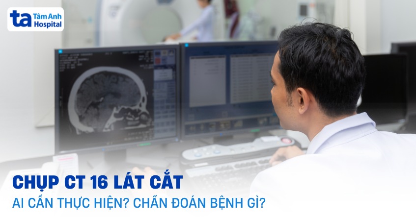 Chụp CT 16 dãy: Khi nào cần chụp, chẩn đoán bệnh gì, ưu điểm?