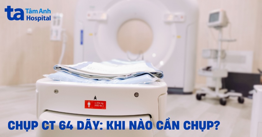 Chụp CT 64 dãy: Khi nào cần chụp, ưu nhược điểm và chẩn đoán