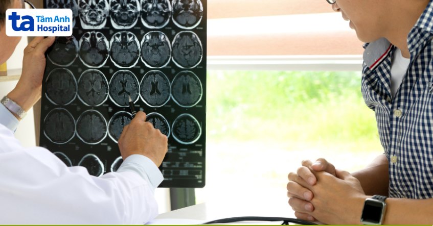 chụp ct 64 lát cắt