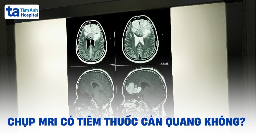 chụp mri có tiêm thuốc cản quang không