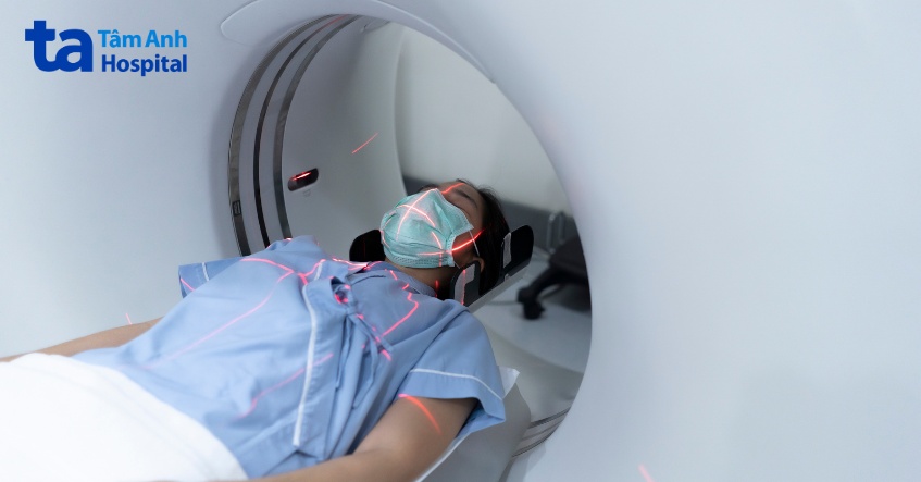 chụp scanner 128 dãy