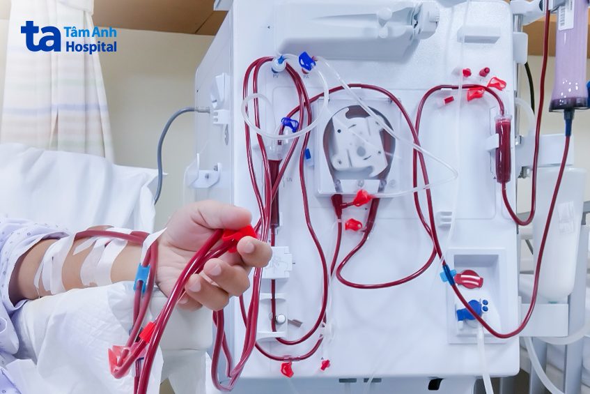 có nên uống nước trong khi đang chạy thận không