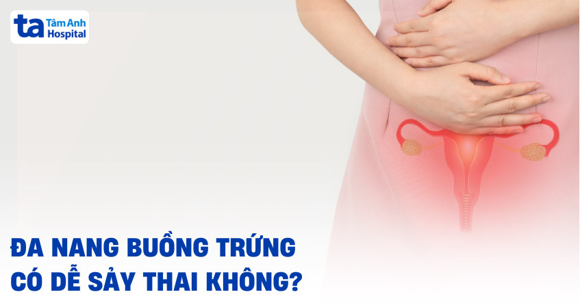Đa nang buồng trứng có dễ sảy thai không? Nguyên nhân vì sao?