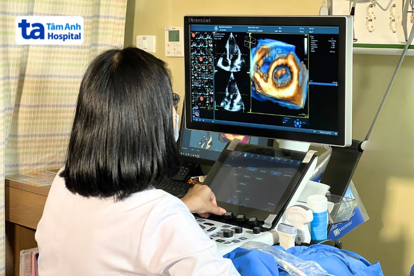 đánh giá chức năng tim bằng siêu âm