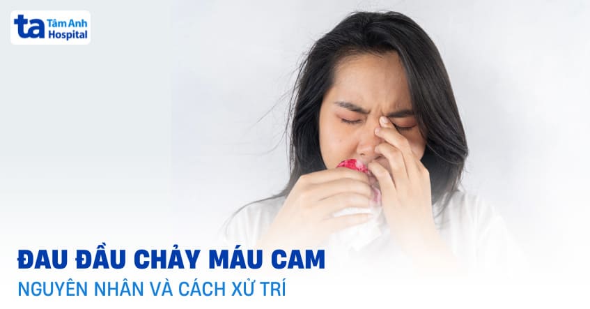 Đau đầu chảy máu cam: Nguyên nhân, cách xử lý và khi nào cần khám?