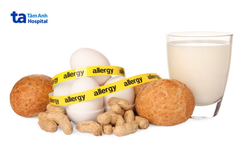 dị ứng thực phẩm gây nhức đầu