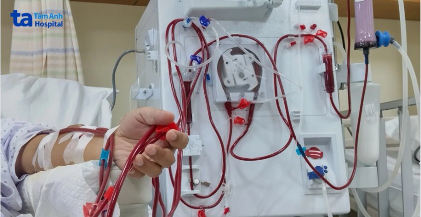 điều trị bằng phương pháp chạy thận