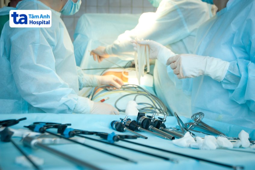 điều trị bệnh viêm túi mật mạn