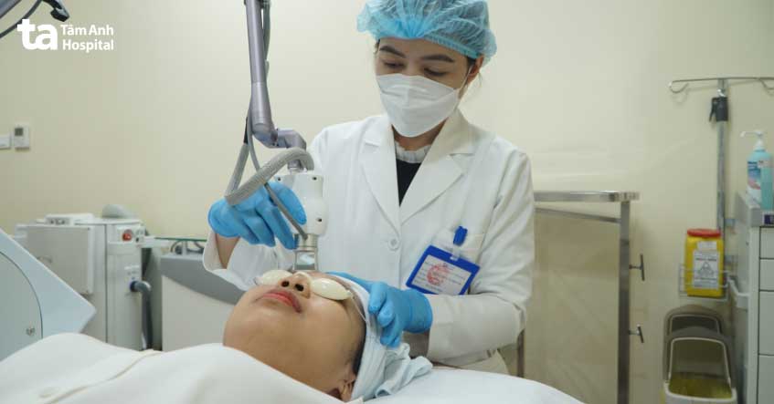 điều trị đồi mồi bằng laser CO2